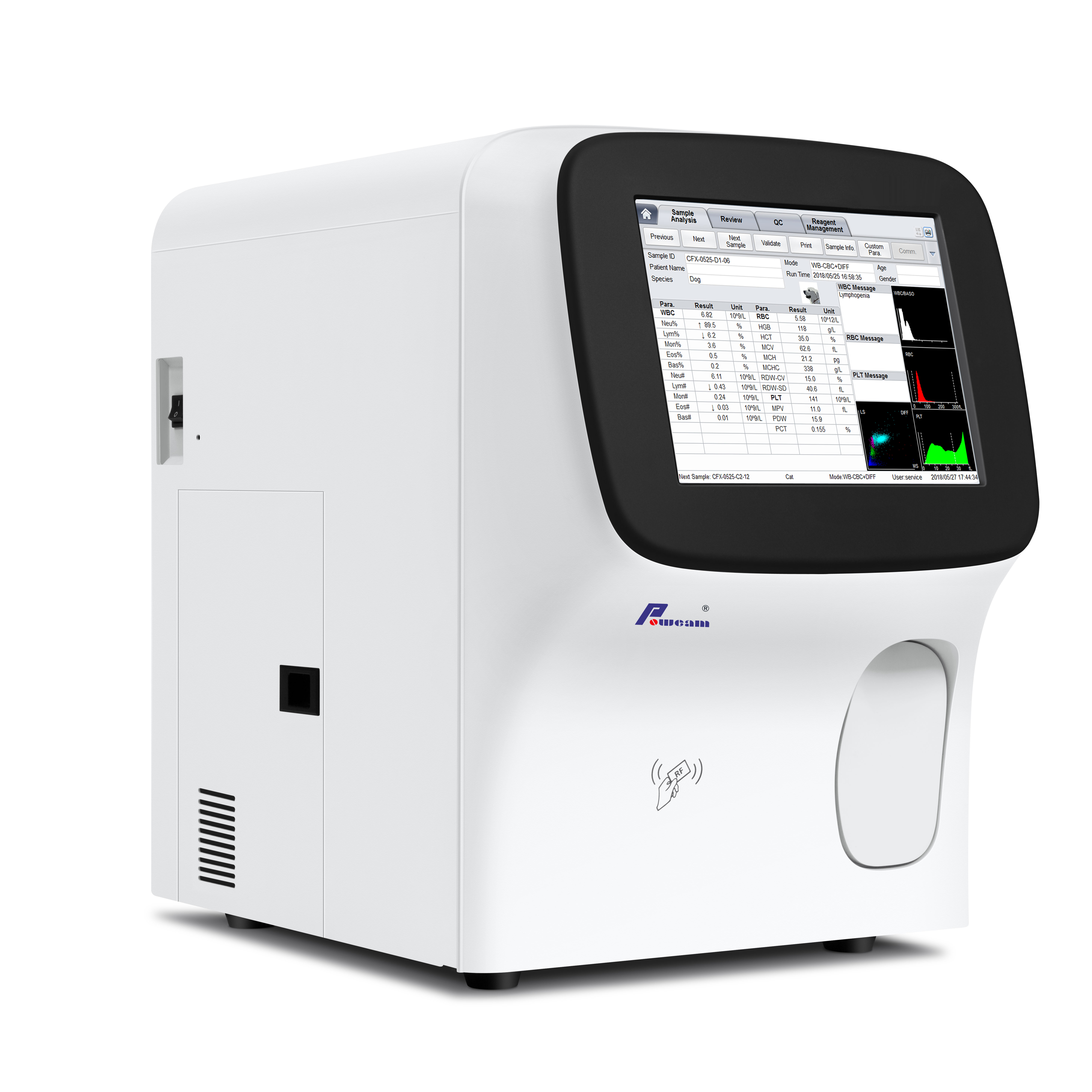 BioBase 5 Part Auto 血液分析仪 Auto 血液分析仪稳定的性能