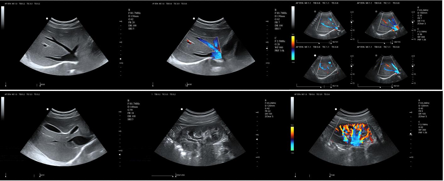 颜色多普勒图像
