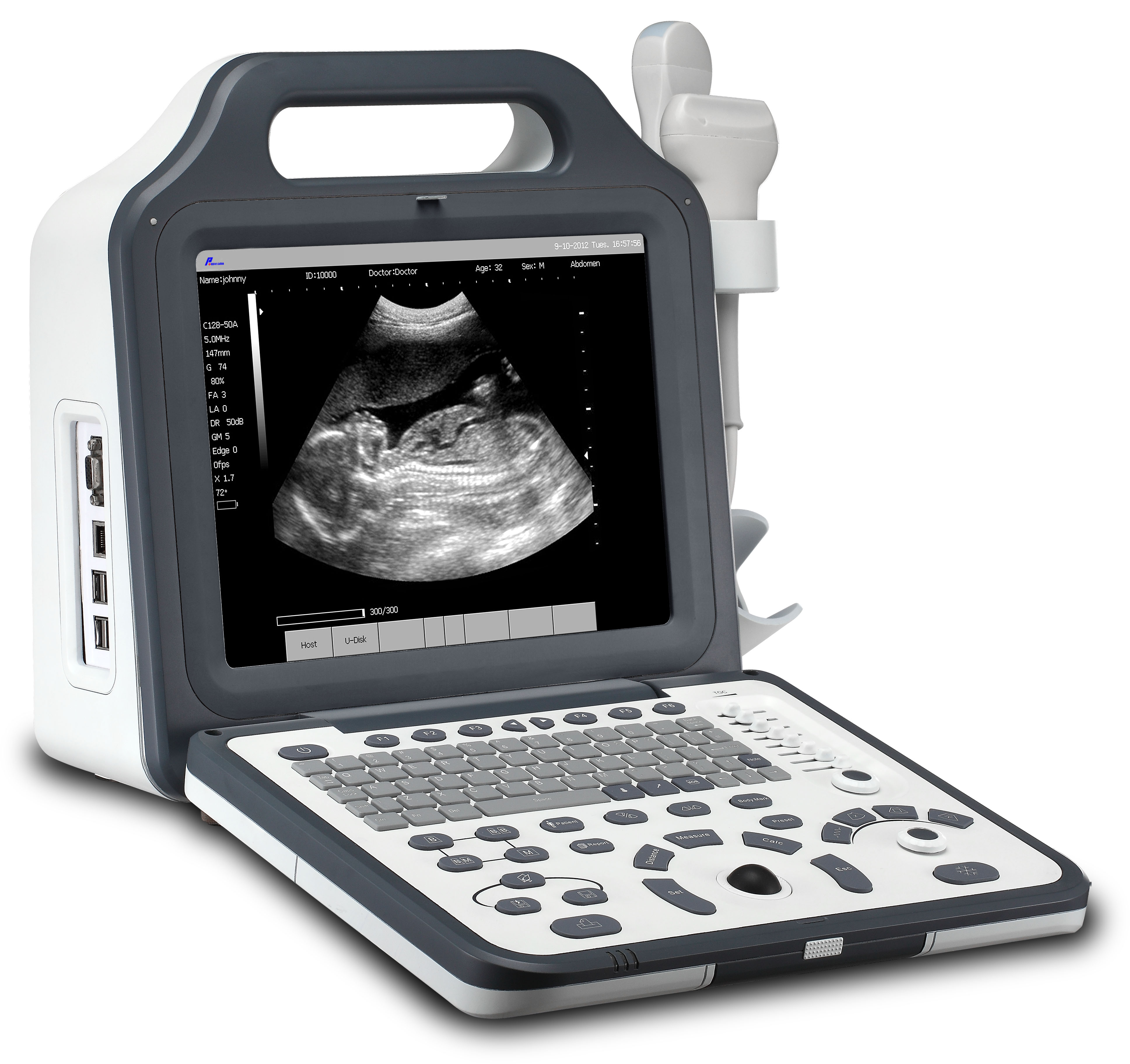CE批准的医院12.1 \“LCD数字笔记本电脑超声（WheC60P）